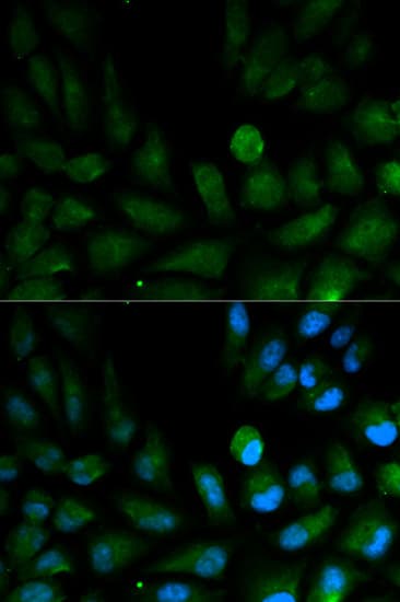 CAPZA2 / CAPZ Alpha 2 Antibody