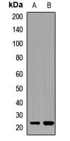 NOSIP Antibody
