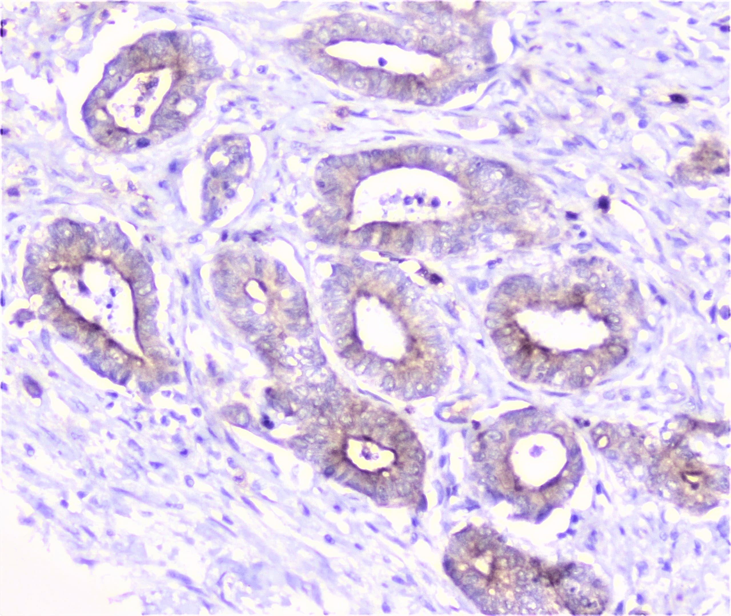 COMP / THBS5 Antibody