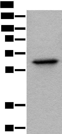 Polyclonal Rabbit anti-Human BAIAP2L1 Antibody (IHC, WB)