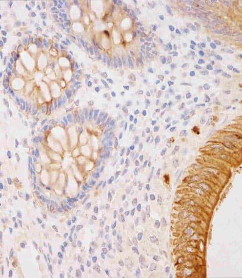 KRT18 / CK18 / Cytokeratin 18 Antibody