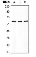 PPP2R5A Antibody (Internal)
