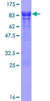Human DRAK1 / STK17A Protein (Recombinant GST)