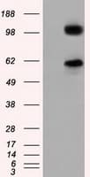 Monoclonal Mouse anti-Human ERIC-1 / TACC3 Antibody (clone OTI8F6, IHC, IF, WB)