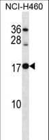 RPL12 / Ribosomal Protein L12 Antibody (aa71-100)