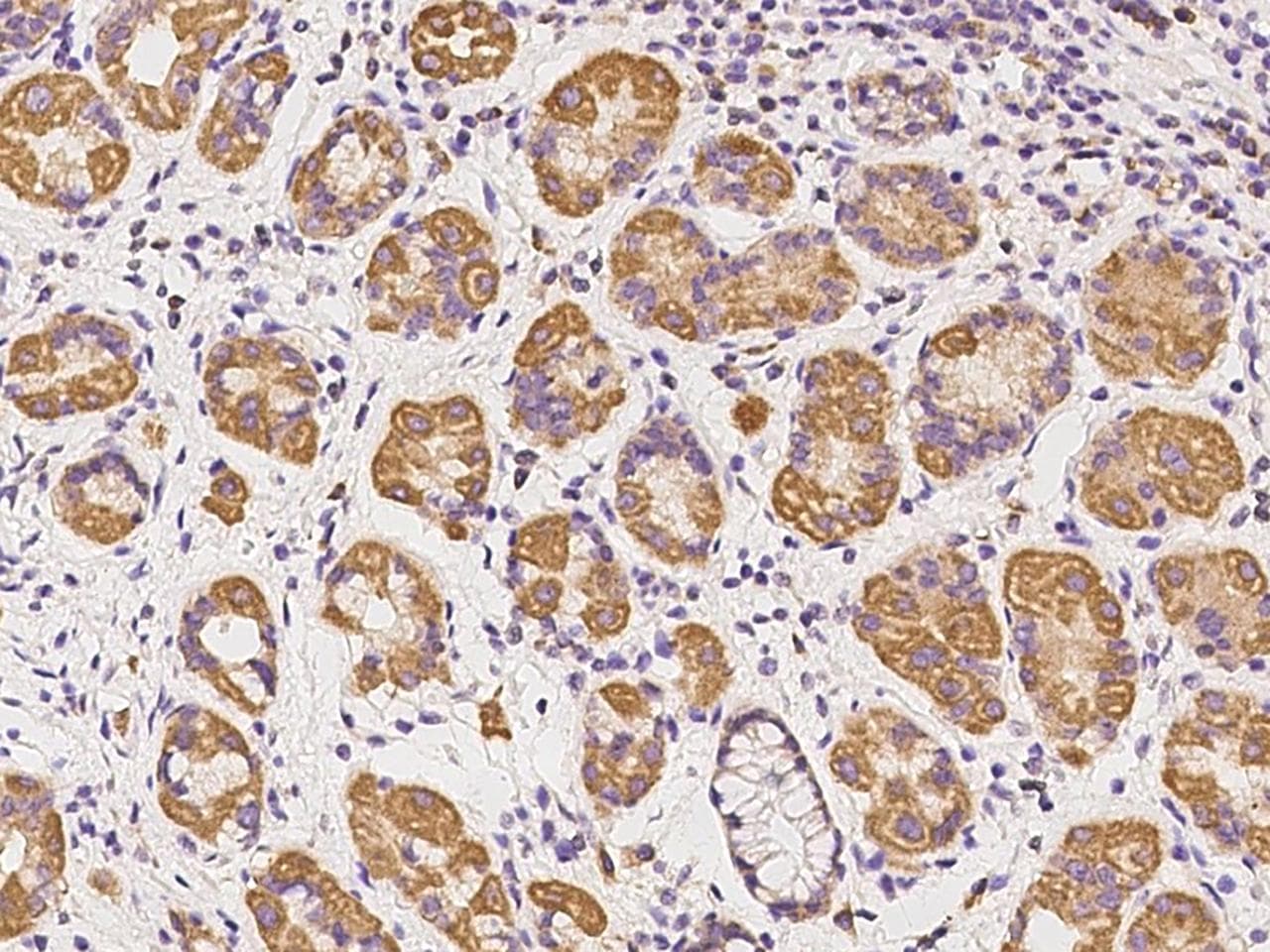 SS18L2 Antibody