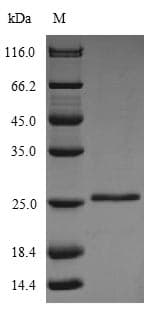 Cow GLTP Protein (Recombinant 6His, N-terminus)