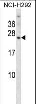 OMP Antibody (aa13-41)