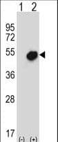 Polyclonal Rabbit anti-Human NR0B1 / DAX1 Antibody (aa304-333, IHC, WB)
