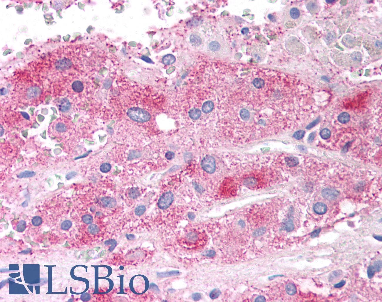 IHC-plus™ SEMA3E / Semaphorin 3E Antibody (aa762-775)