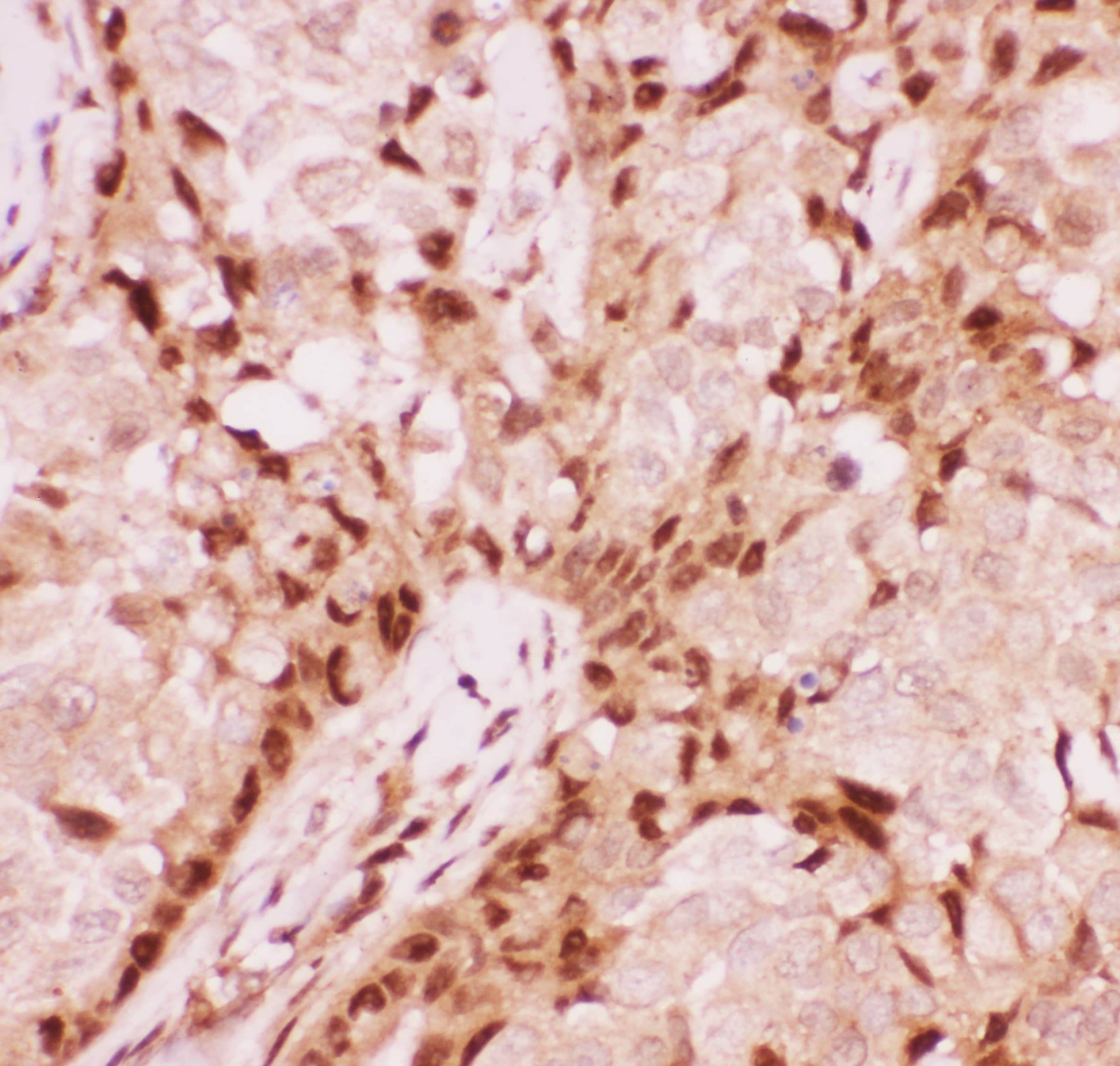 AML1 / RUNX1 Antibody (aa200-233)