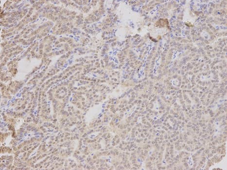 Polyclonal Rabbit anti-Human TMPO / TP / Thymopoietin Antibody (IHC, IF, WB)