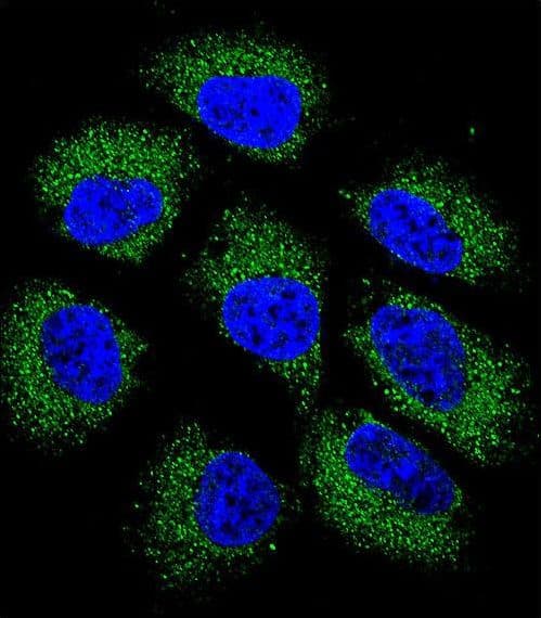 GSR / Glutathione Reductase Antibody (aa380-408)
