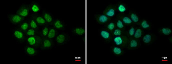 MTA1 Antibody (aa391-708)