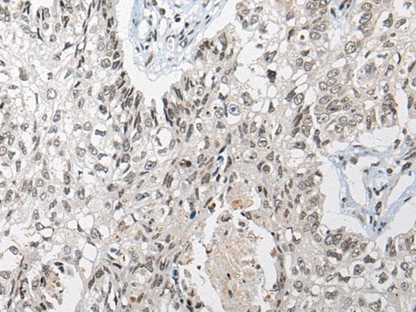 DGK-IOTA / DGKI Antibody
