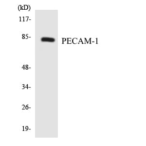 Polyclonal Rabbit anti-Human PECAM-1 / CD31 Antibody (aa660-709, IHC, WB)