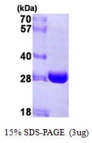Human NQO2 Protein (Recombinant His)