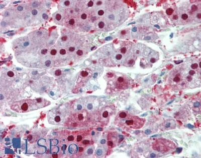 IHC-plus™ Polyclonal Rabbit anti-Human RNF8 Antibody (aa1-260, IHC, WB)