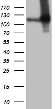 Monoclonal Mouse anti-Human APBB1IP / RIAM Antibody (clone OTI6E3, Carrier-free, IHC, WB)