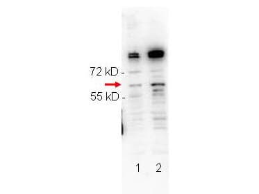 RELA / NFKB p65 Antibody (phospho-Ser276)