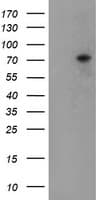 EEYORE / TIGD1 Antibody (aa1-267, clone OTI4G9)