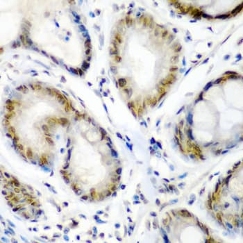 SS18 Antibody