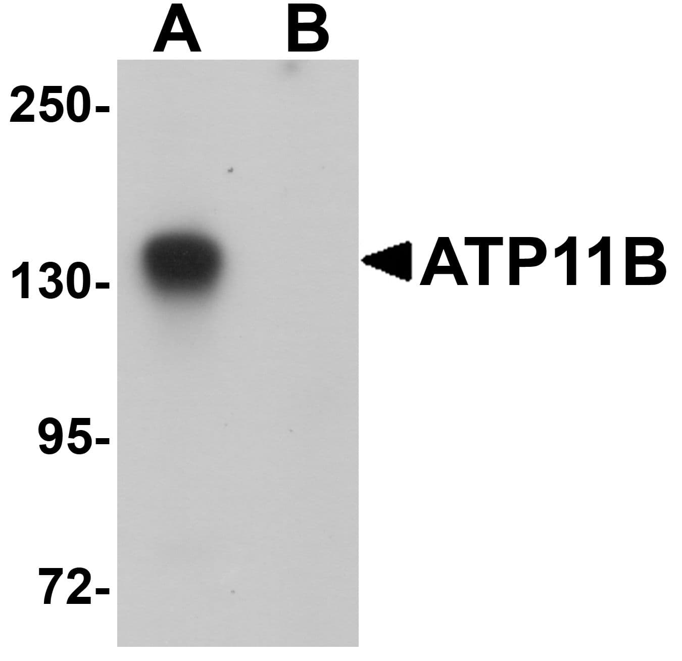 IHC-plus™ Polyclonal Rabbit anti-Human ATP11B Antibody (IHC, IF, WB)