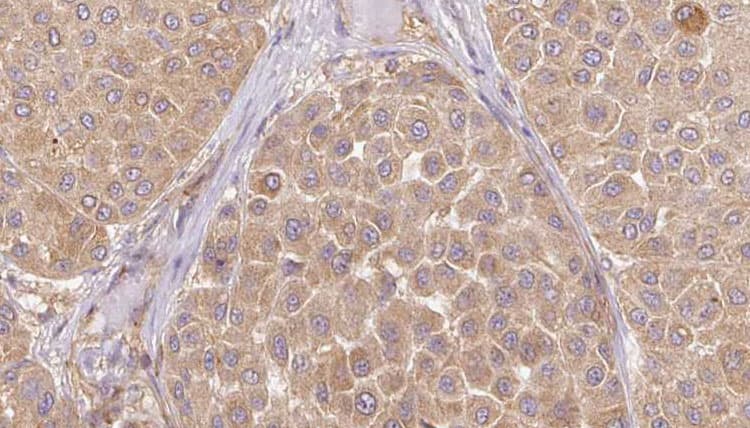 IGFL1 Antibody