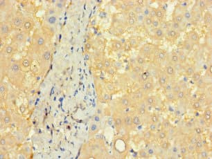 Polyclonal Rabbit anti-Human CCDC68 Antibody (Coiled-coil domain)