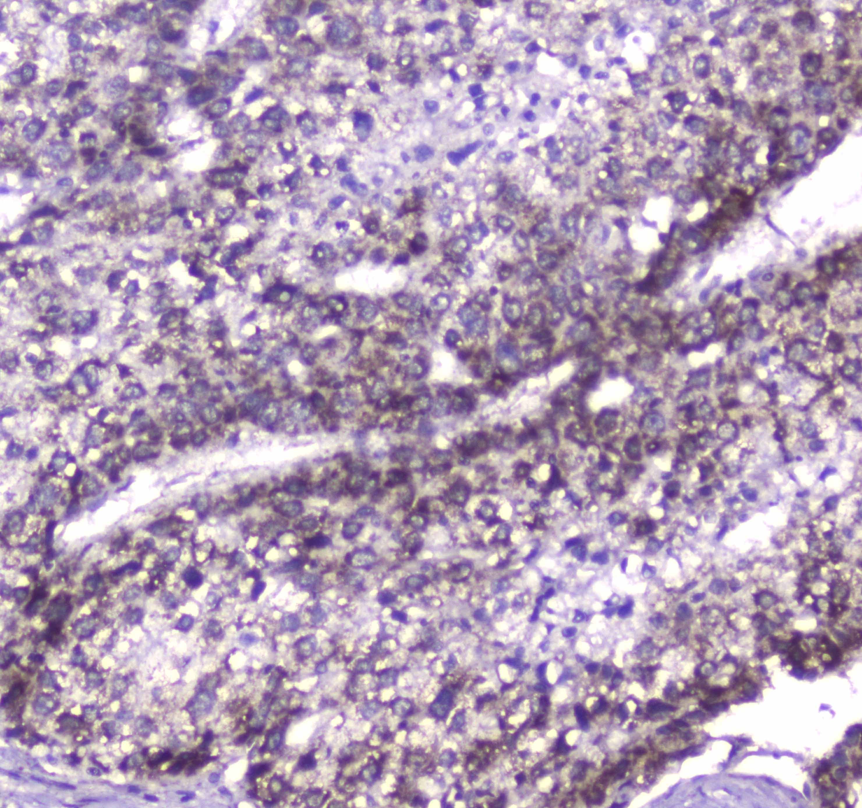 CLPP Antibody