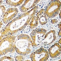 PHYKPL / AGXT2L2 Antibody (C-Terminus)