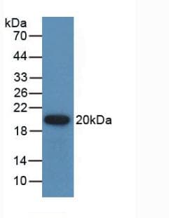 PathPlus™ GREM1 / Gremlin-1 Antibody (aa26-184)
