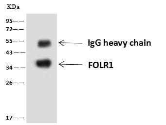 FOLR1 / Folate Receptor Alpha Antibody (Preservative Free)