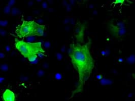 BRAF / B-Raf Antibody (clone OTI1D2)