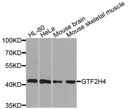 Polyclonal Rabbit anti-Human GTF2H4 / TFB2 Antibody (WB)