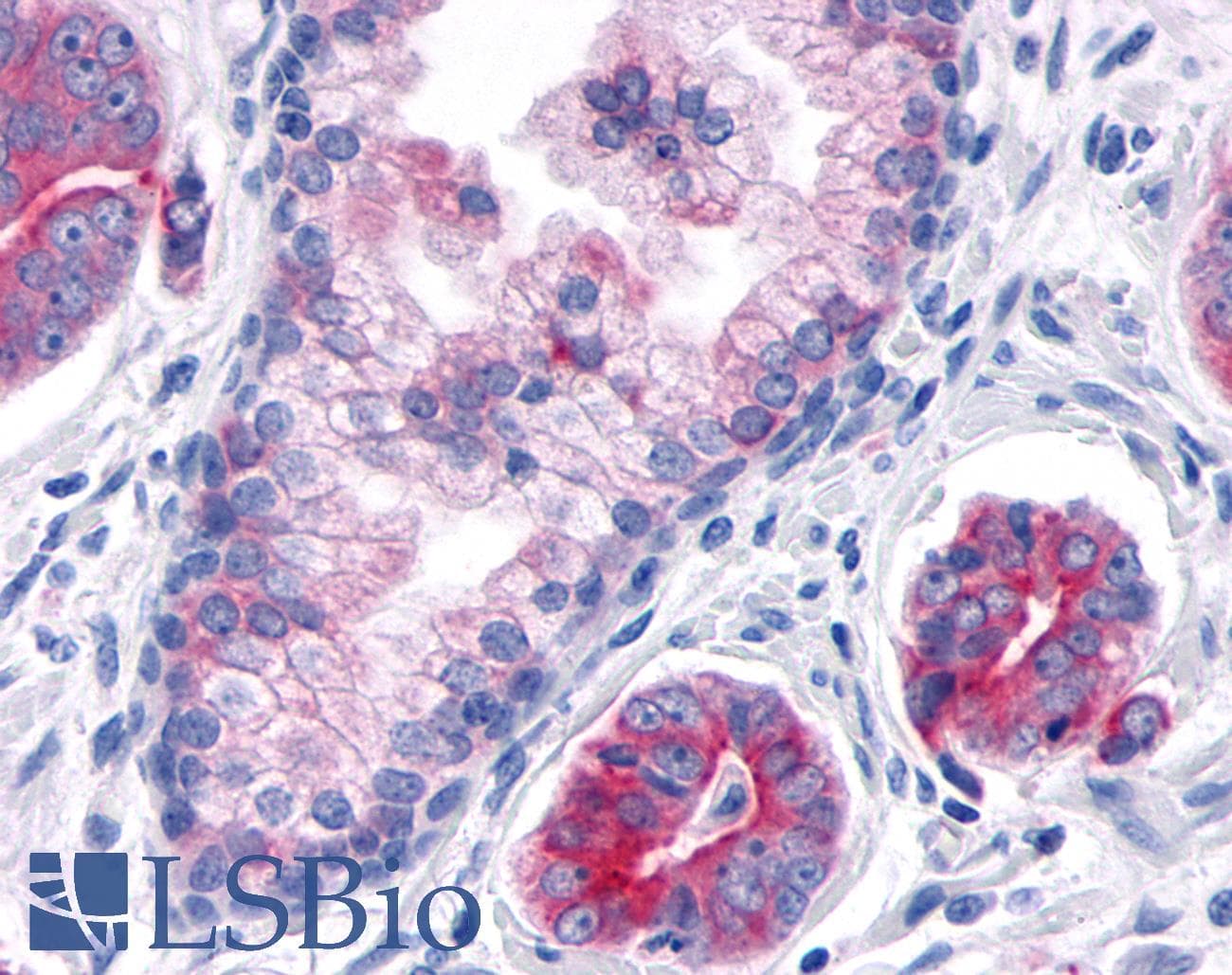 PathPlus™ TNIK Antibody (Internal)