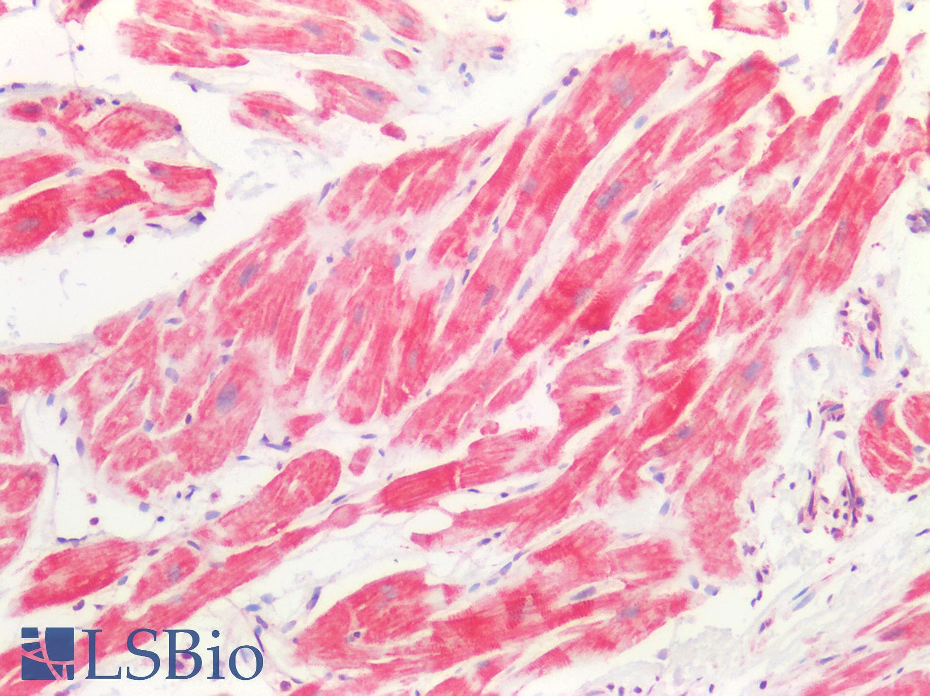PathPlus™ ROS1 / ROS Antibody (aa1744-1777)