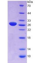 Rat GAS6 Protein (Recombinant His)