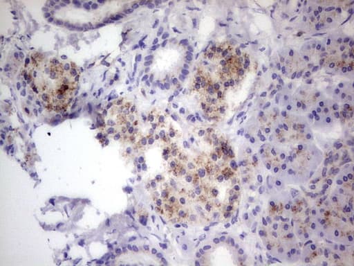 GBA / Glucosidase Beta Acid Antibody (aa40-315, clone OTI2C12)