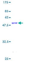 Human CBFB Protein (Recombinant GST)