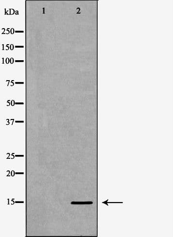 HIST3H3 Antibody (Methyl-Lys27)