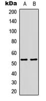 Polyclonal Rabbit anti-Human TP53 / p53 Antibody (Acetyl-Lys386, IHC, IF, WB)