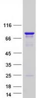 Human CCDC9 Protein (Recombinant Myc-DDK (Flag))