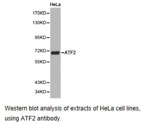 Polyclonal Rabbit anti-Human ATF2 Antibody (IHC, WB)
