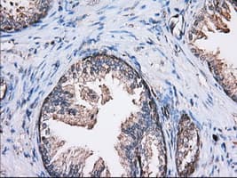 Monoclonal Mouse anti-Human TS / Thromboxane Synthase Antibody (clone OTI1H1, IHC, IF, WB)