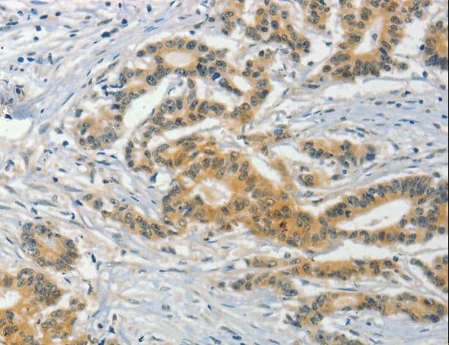 ASB8 Antibody