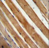 Polyclonal Rabbit anti-Human SLC25A12 / ARALAR Antibody (aa1-30, IHC, WB)