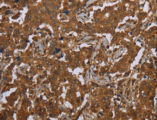 Polyclonal Rabbit anti-Human SCGB1D2 / Lipophilin B Antibody (IHC)