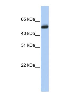 Polyclonal Rabbit anti-Human CYP4B1 Antibody (aa72-121, WB)
