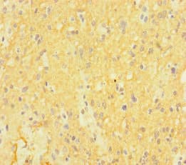 Polyclonal Rabbit anti-Human CTNND2 / Delta-2 Catenin Antibody (aa4-308, IHC, IF)